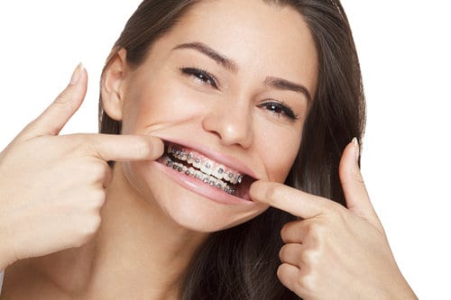 Adult Braces Mt Waverley Braces For Adults Dentist330 