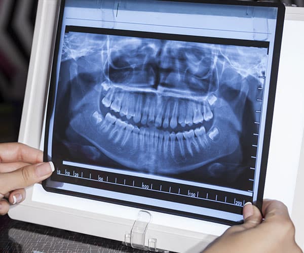 dental x ray mount waverley